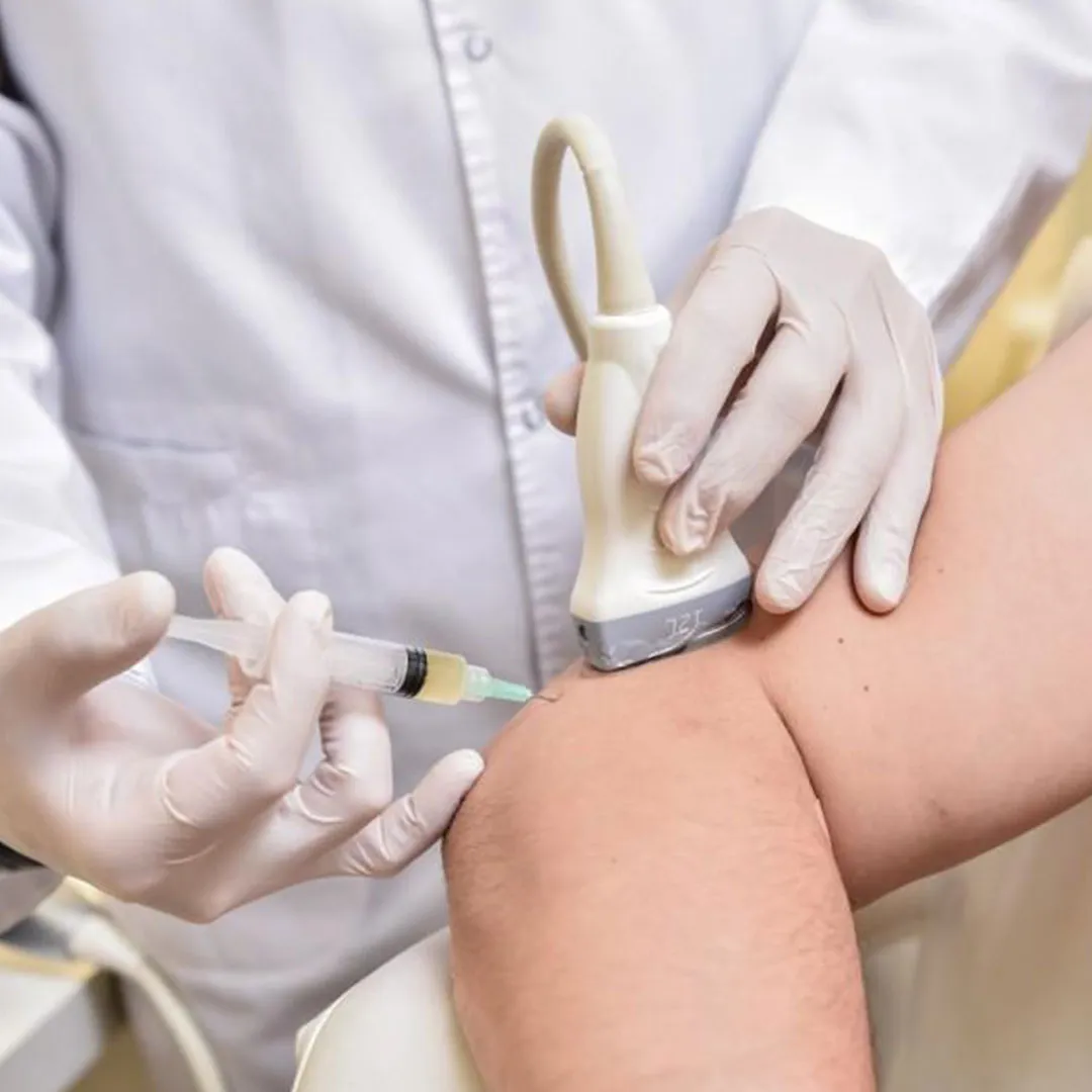 Steroid injection, Ultrasound Injections at Physio & More, Kingston